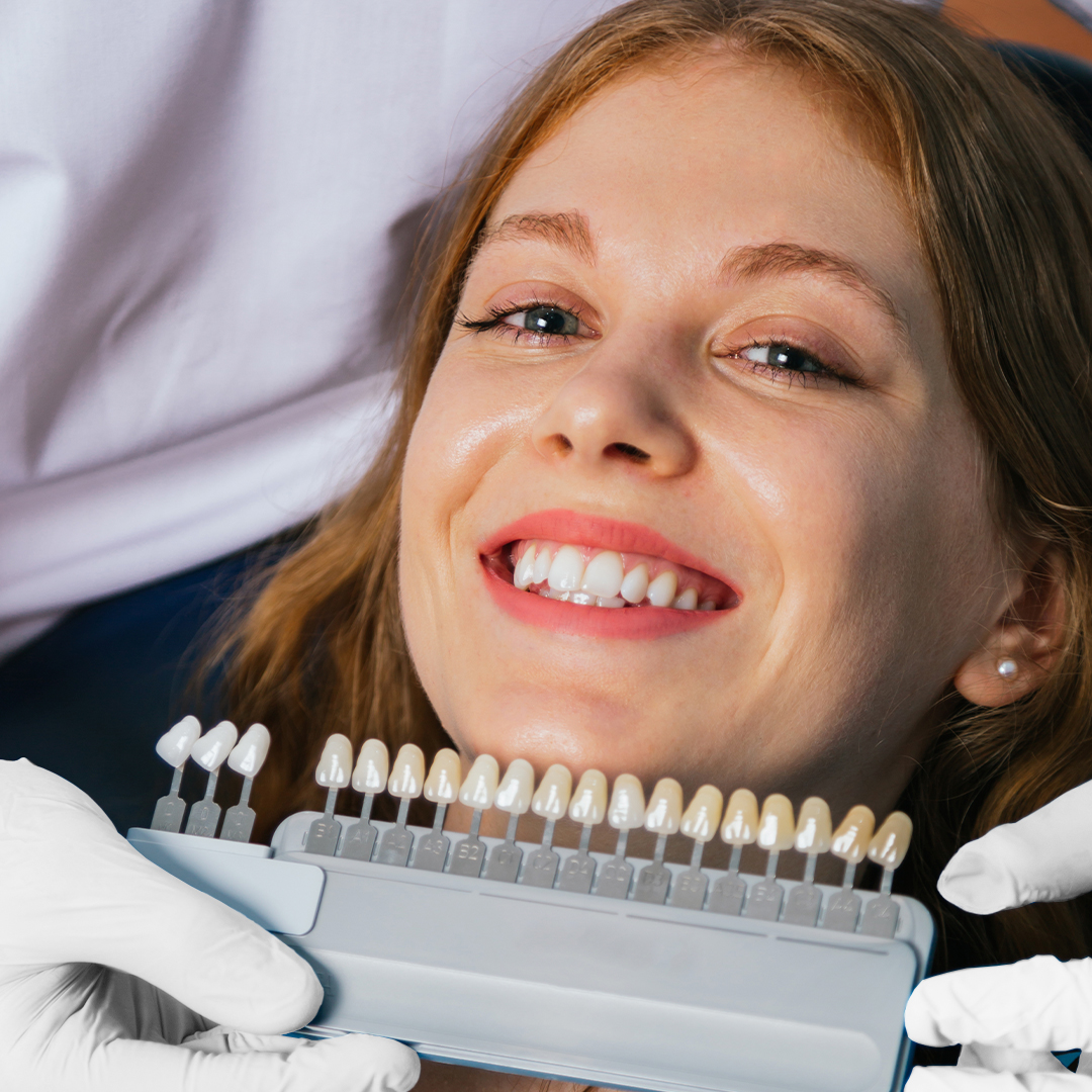 Lentes Dentárias e Implantes