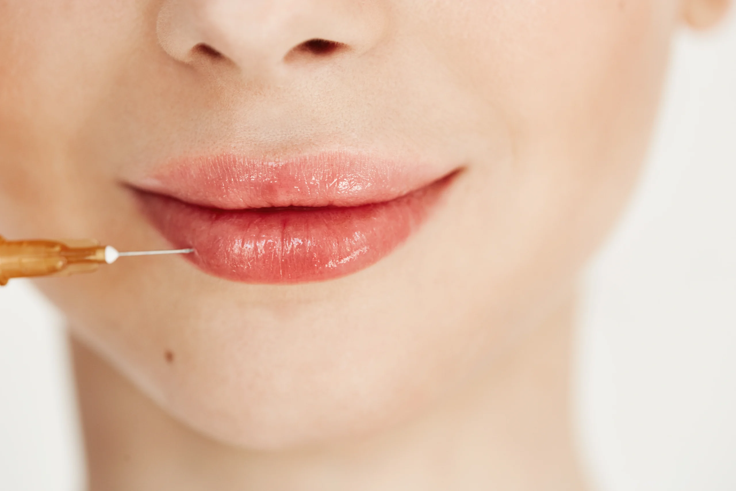 Preenchimento labial