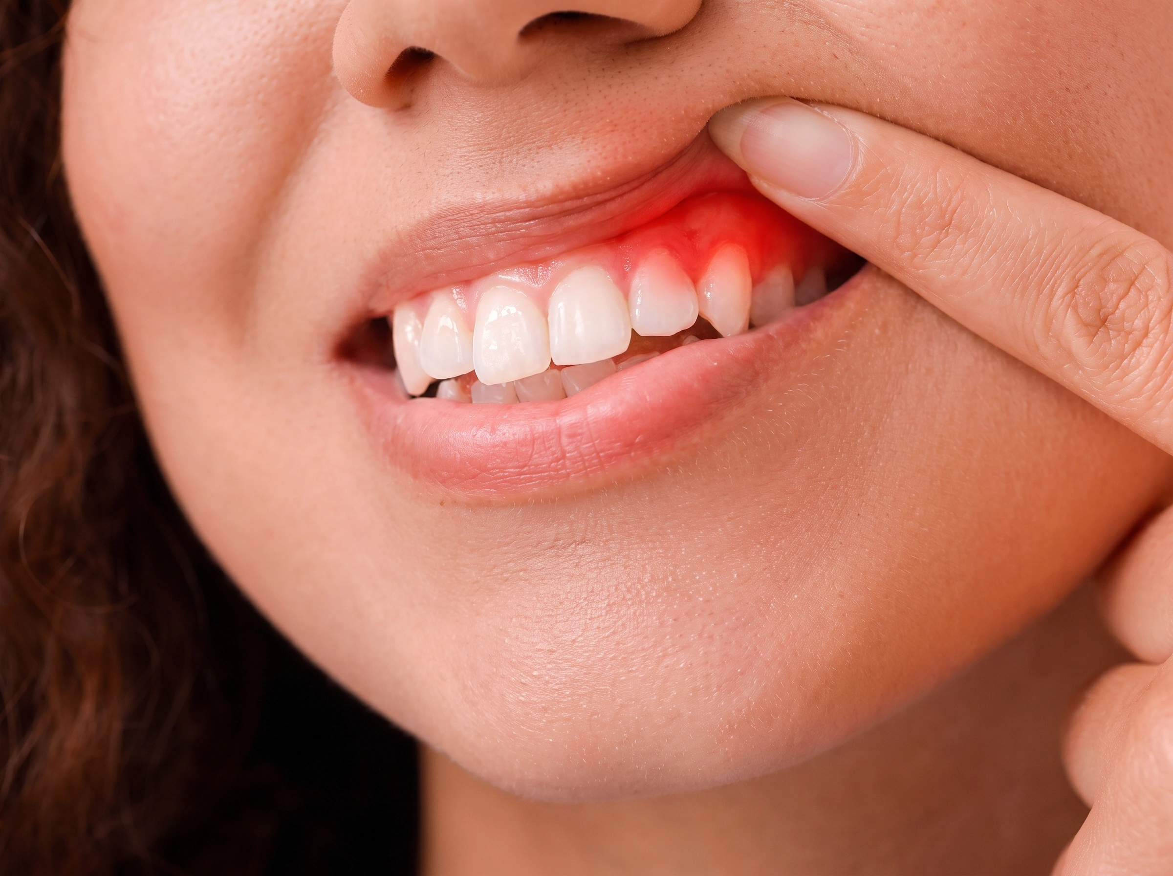 Periodontia: Tratamento das gengivas, ossos e fibras periodontais